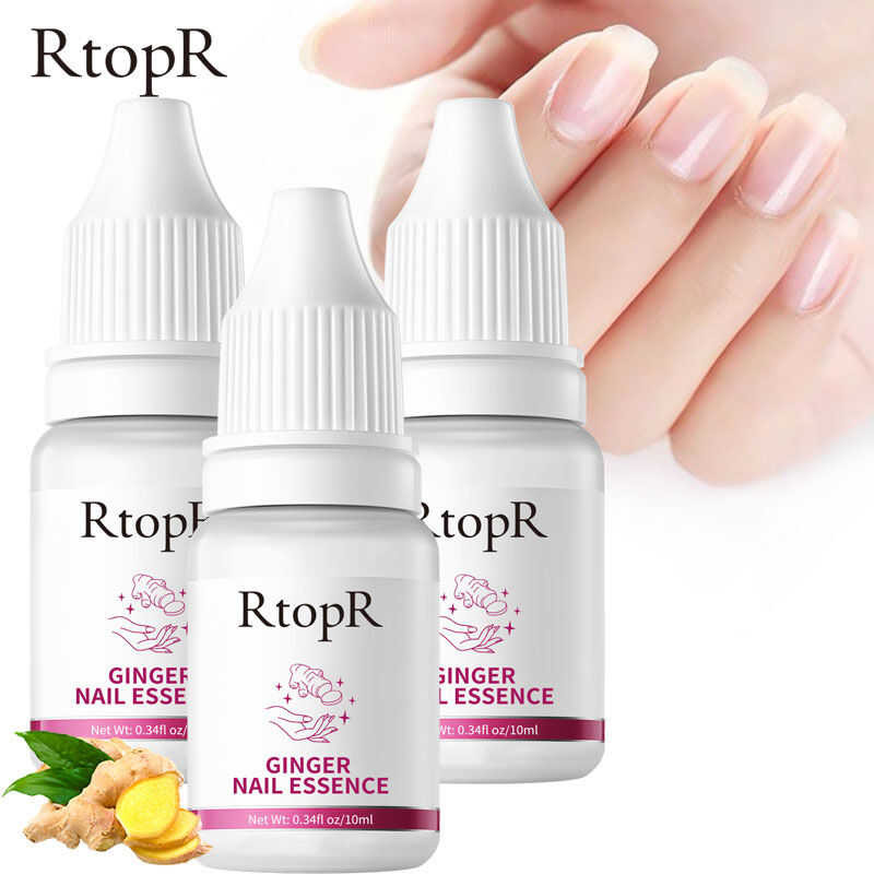 3 Rtopr ชิ้น FDA ยาทาเล็บ ขิง เซรั่มรักษาเล็บ เซรั่มซ่อมเซมเล็บ GINGER NAIL ESSENCE ต้นไผ่ปลอม ปัจฉิ