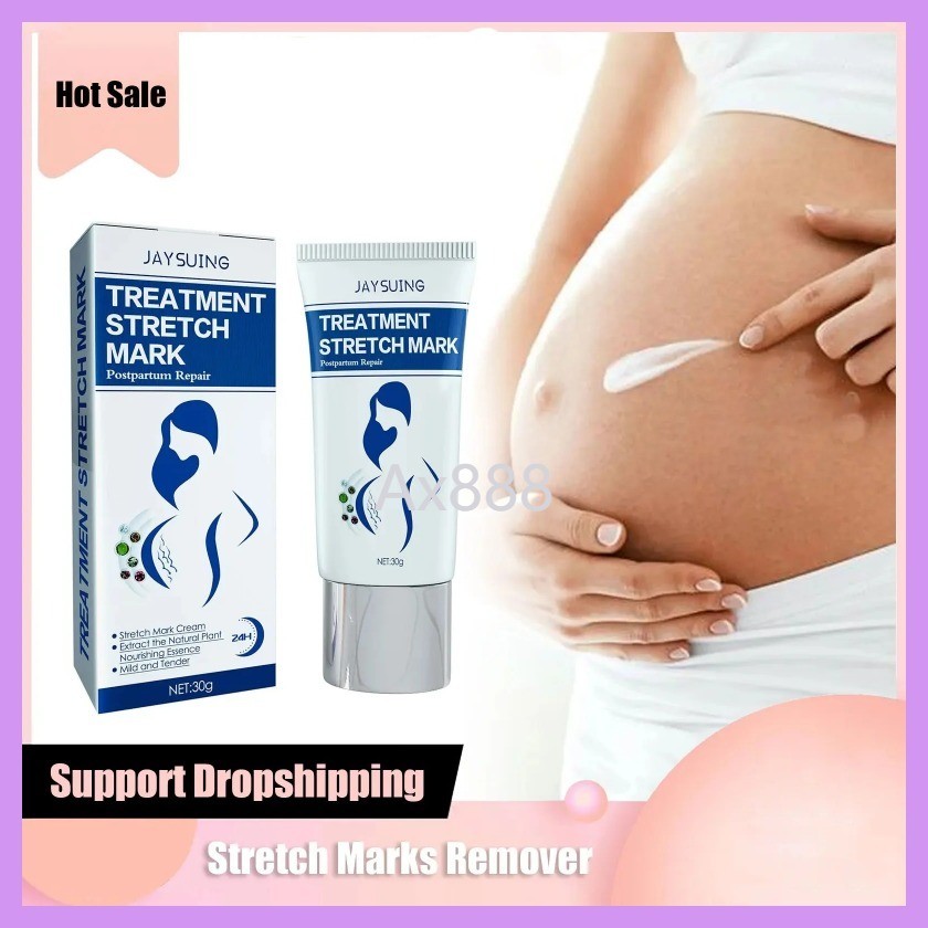 Stretch Marks Removal Cream การตั้งครรภ์ Breast Hip Mark คลอดบุตร SCAR Repair เพิ่มความยืดหยุ่นผิว
