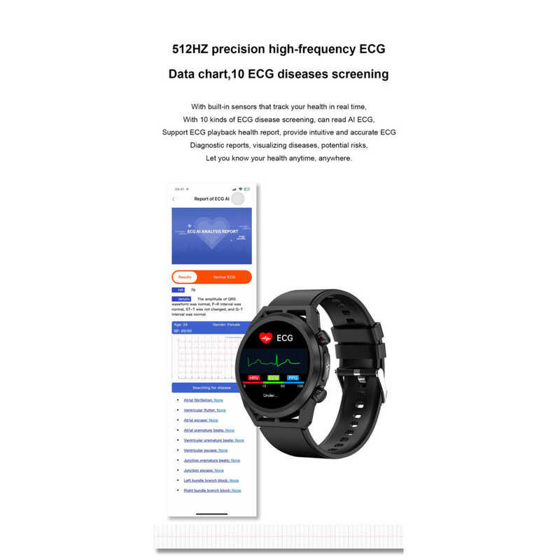 ECG XIAOMI 2023 Smart Watch ผู้ชายบลูทูธออกซิเจนในเลือดกลูโคสคว