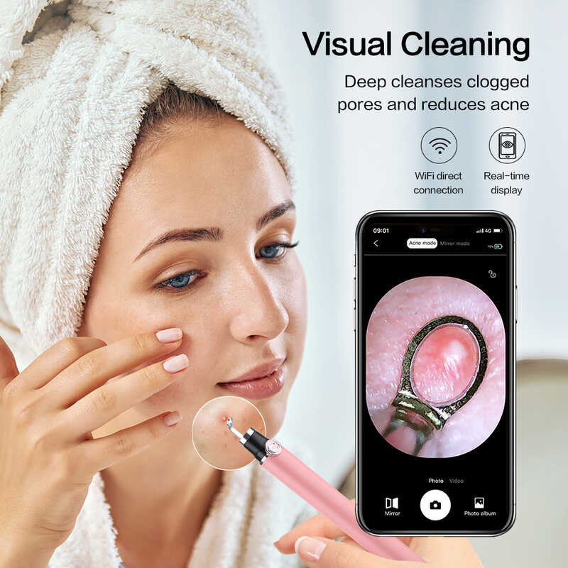มองเห็นสิวเข็มกำจัดสิวหัวดำด้วยกล้อง สมาร์ท Wifi Endoscope ใบหน้ารูขุมขนทำความสะอาดสิวบีบผิว