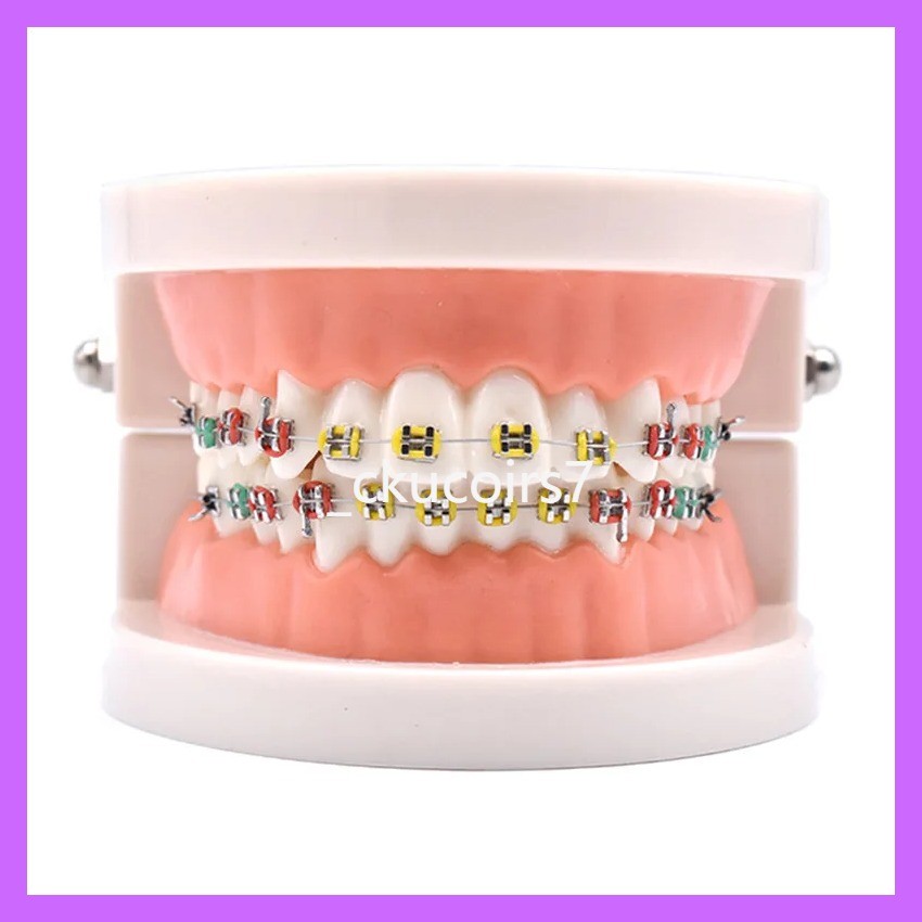 tk ขายร้อน  Dental Model With Braces Dentistry Materials Orthodontic Models Gum Tooth Teeth Model F