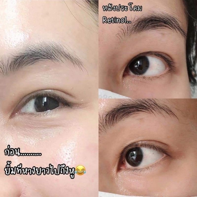 ♞,♘,♙เรตินอลขายดีที่สุด Kiehl's Retinol Skin-Renewing Serum ขนาด 4 ml.