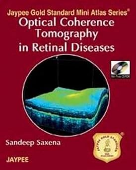Jaypee Gold Standard Mini Atlas Series Optical Coherence1/E /
