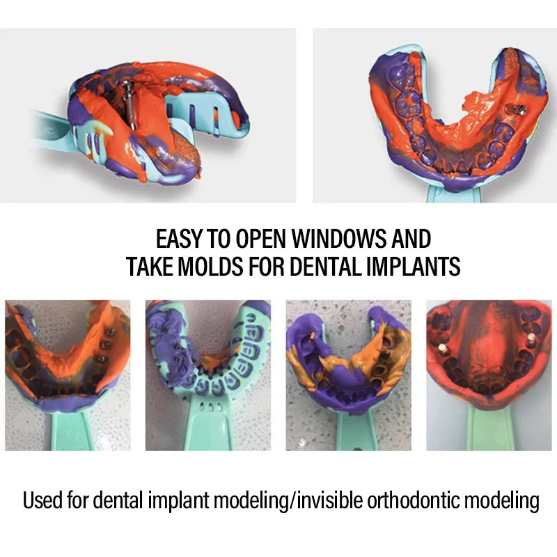 Denspay 6 ชิ้น/เซ็ตทันตกรรม Impression ถาดพลาสติก S/M/L ทันตกรรม Implant ถาดเต็มปากที่ถอดออกได้บางส่วนแม่พิมพ์ถาดง่ายพับ ราคา ถูกที่สุด ดีลบีเคเค แกลเลอรีภาพที่ 3