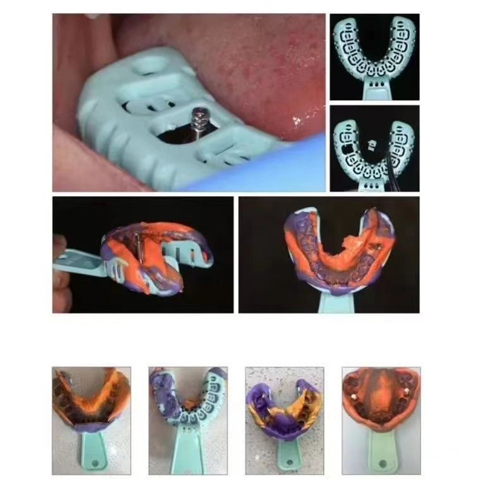 Denspay 6 ชิ้น/เซ็ตทันตกรรม Impression ถาดพลาสติก S/M/L ทันตกรรม Implant ถาดเต็มปากที่ถอดออกได้บางส่วนแม่พิมพ์ถาดง่ายพับ ราคา ถูกที่สุด ดีลบีเคเค แกลเลอรีภาพที่ 7