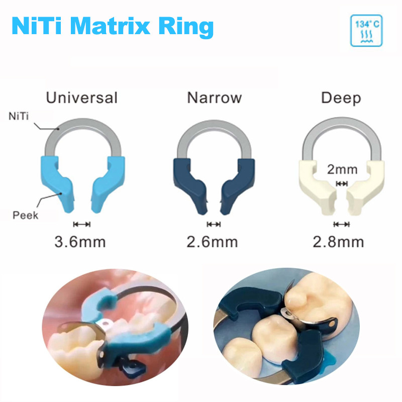แถบเมทริกซ์ทันตกรรม NITI โลหะ Matrices Clamp แหวนส่วน