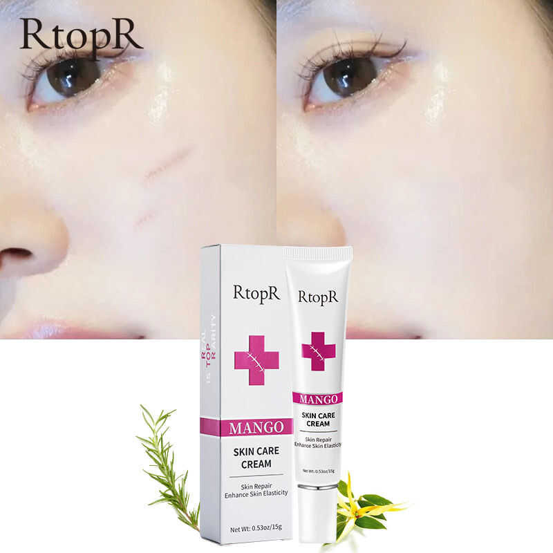 ▣ Rtopr 2Pcs FDA ครีมขจัดแผลเป็น ครีมบํารุงผิว แผลเป็นจ
