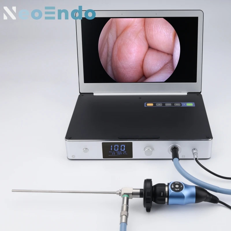 3 In 1 Portable Medical Endoscope Camera Full HD 1080P With 11.6 Inch Monitor And 30W LED Light Sou