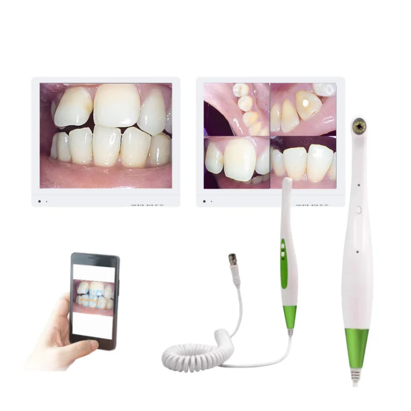 17inch Dentistry Monitor With Intra Oral Camera 16 Mega Pixels Wireless Wifi Endoscope Dental Chair