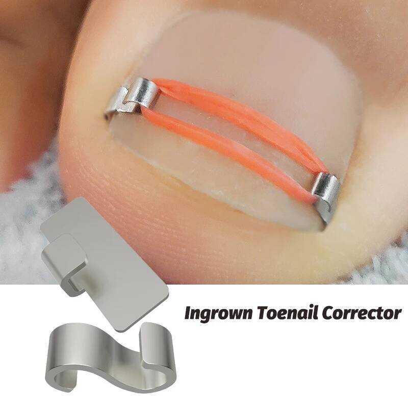 1/2 ชิ้น Corrector Pedicure กู้คืน Embed Toe Nail Treatment Professional คุด Toenail Correction Foot