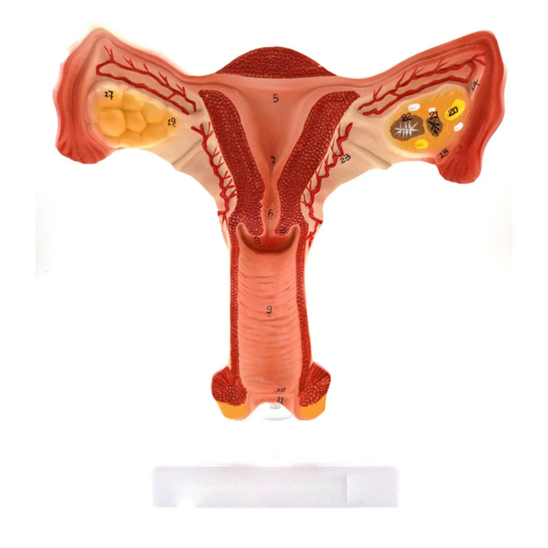 PVC Uterus and Ovary Anatomical Model Human Female Medical Anatomy Internal Genital Organ