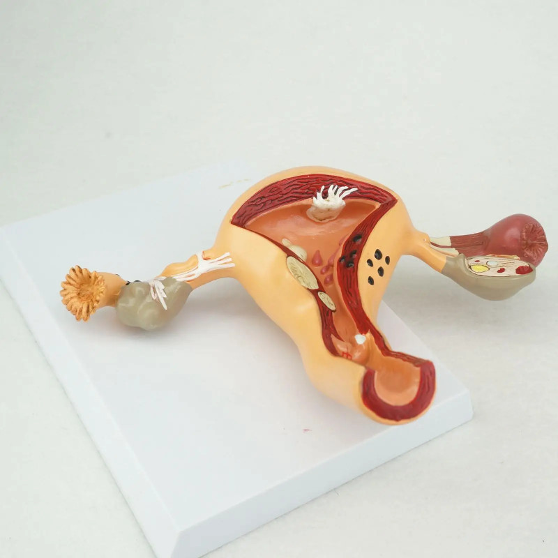 PVC Pathological Uterus and Ovary Anatomical Model Human Female Medical Anatomy Learning Kit