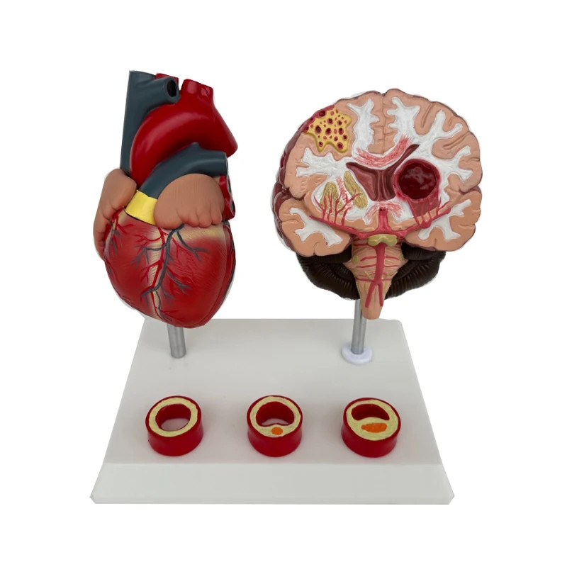 Human brain anatomy, brain pathology, construction, cerebrovascular lesions, brain models, heart bl
