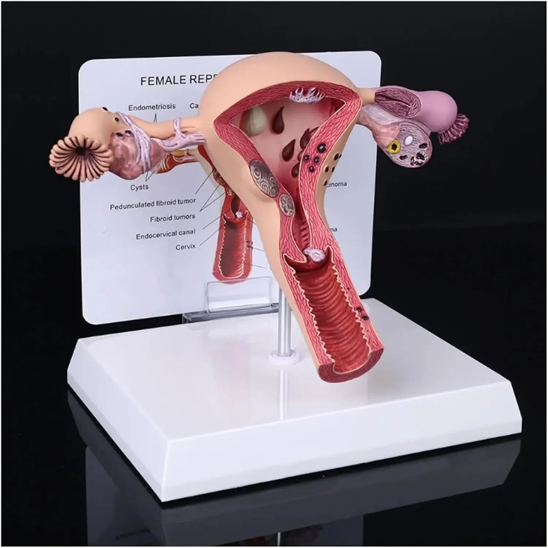 Ovary Pathological Model Uterus Female Reproductive Organ Model  for Doctors Office School Teaching