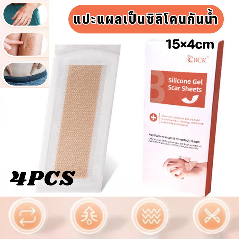 แผ่นแปะแผลเป็นซิลิโคนกันน้ำ กล่อง 4 ชิ้น ดูแลแผล แผ่นแปะซ่อมแซมแผลเป็น 15×4 ซม. ตัดได้ตามต้องการ