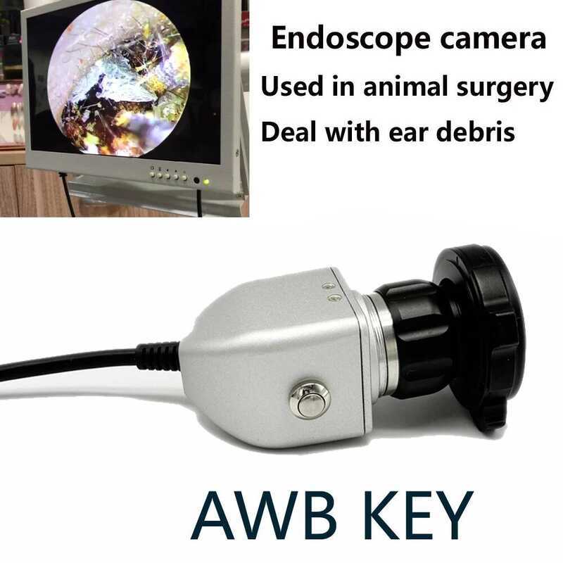 กล้องเอนโดสโคปทางการแพทย์ AWB Key พร้อมกล้อง CCD สำหรับตรวจหู คอ จมูก พร้อมข้อต่อ F22mm เชื่อมต่อกับ