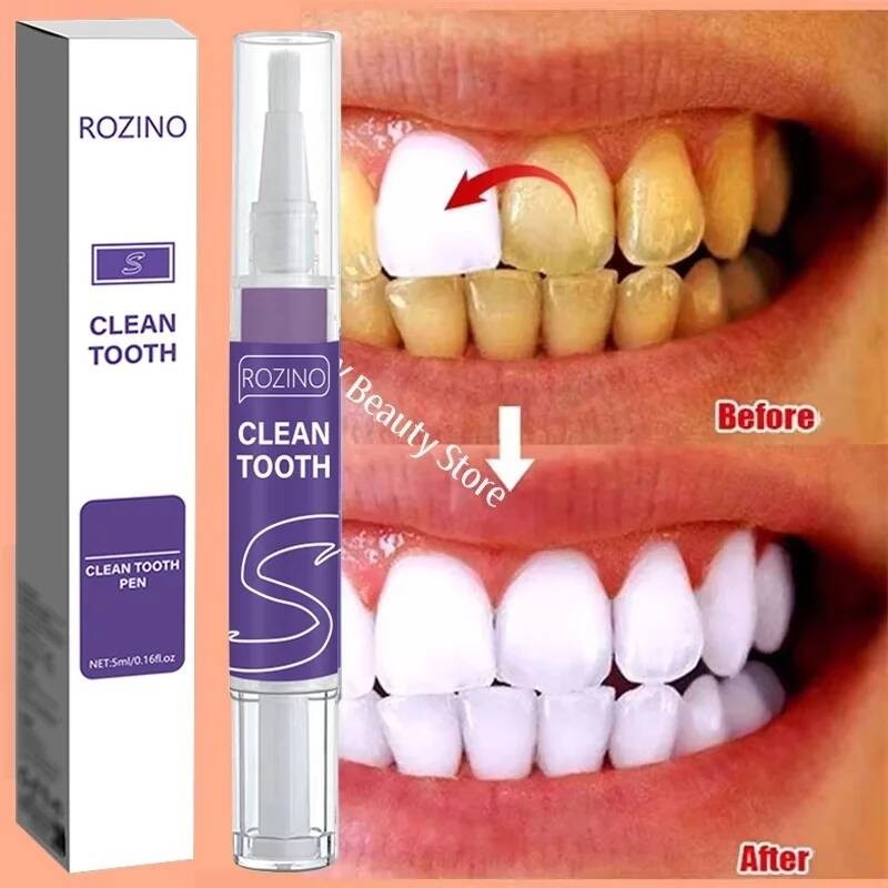 Teeth Whitening Pen Effective Remove Plaque Stains Oral Hygiene Cleaning Dental Bleaching Tools Fres