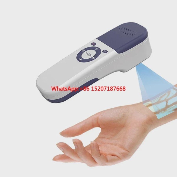 Portable Vein Finder Infrared  Viewer with Table Stand or Mobile   Scanner