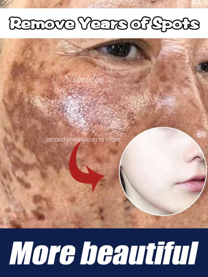 Sale Facial care tools Solve Melasma Dark Spots Fast Skin Lightening Suitable for all ages Multiple