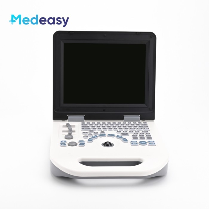 12 Inch Portable White and Black Ultrasound Pregnancy Scanner