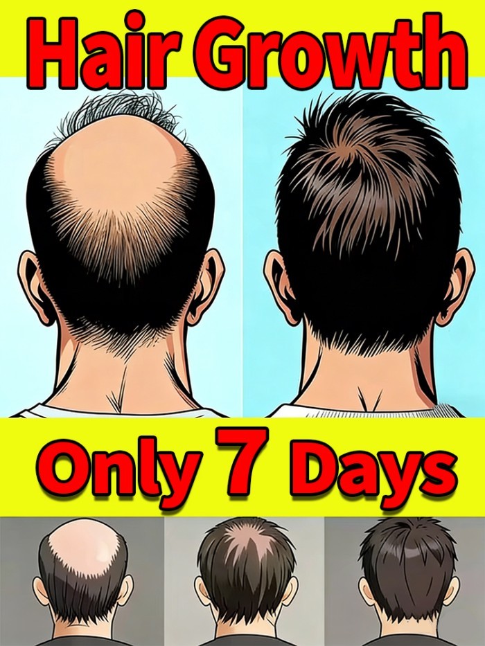 Generation-2,M-shaped,to solve hair problems and protect your scalp health,care tool