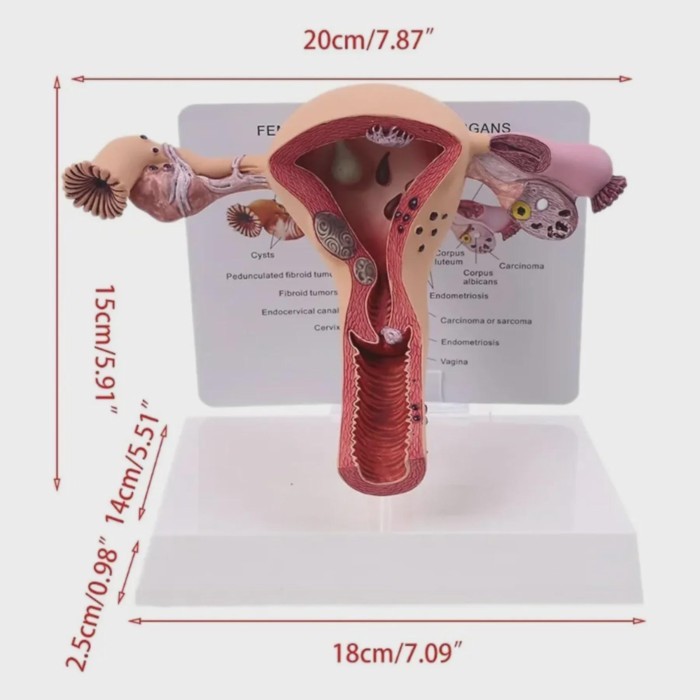 1Pcs Uterus Ovary Model Pathological Uterus Ovary Anatomical Model Anatomy Cross Section Study Tool