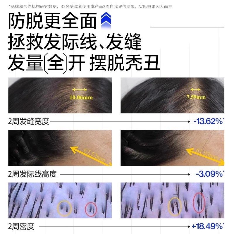 EHD Anti-hair Loss Shampoo, Anti-breakage, Firm Hair, Dense Hair, Oil Control, Anti-dandruff, Genui