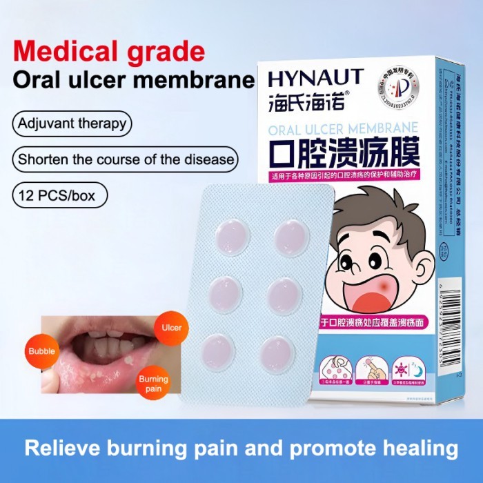 Quick Care Mouth Ulcer Patch Oral Mouth Wound Dressing For Canker Sores Fast Pain Relief Canker Sor