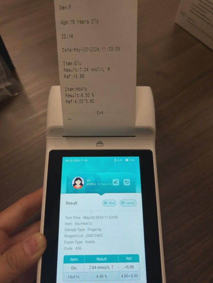 Automatic 3 In1 Urine Biochemical Urine  Portable Analyzer  Urine Analysis System for test ACR Cret