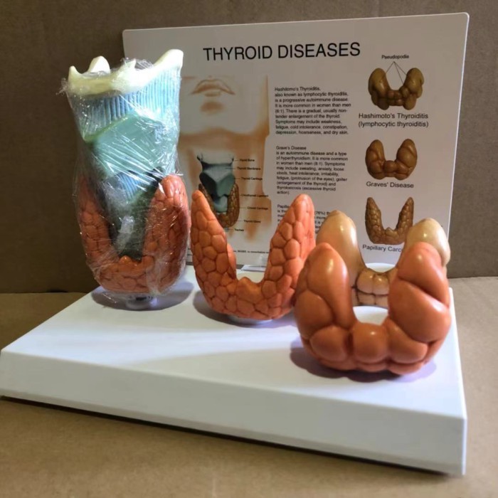 Human Anatomical Thyroid Gland Model Pathology Anatomy Display Thyroid Anatomy Model with Instructi