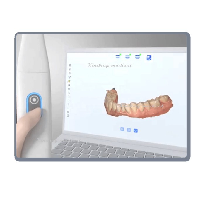 Products Portable Handheld Lab CAD Cam 3D Scanner Brand 3d Intraoral Scanner