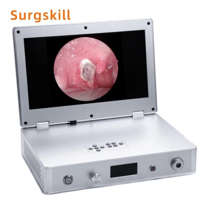 Full HD 1080P Integrated Endoscope Camera System with 40W Light Source and 16 Inch Medical Monitor