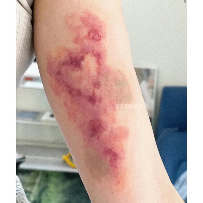Love Bruises Sick ความงามสติกเกอร์รอยสักสี Ins ล้างทําความสะอาดได้สาวสวยแขนจําลองภาพวาดที่สมจริง