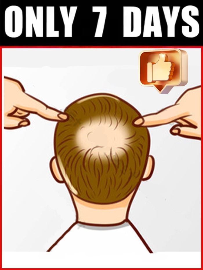 Generation-2, free shipping, helping people who hair solve their problems,Hot sale