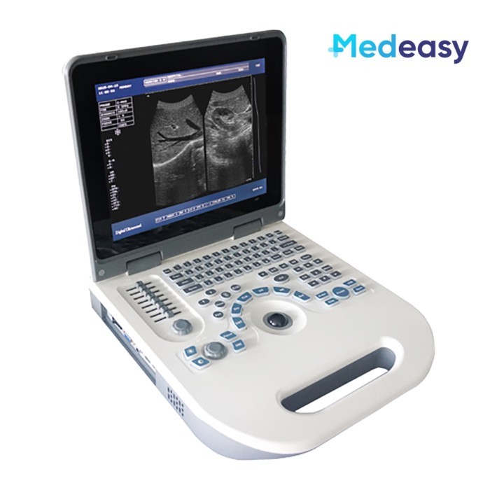 12 Inch LED Laptop Portable Notebook Digital Ultrasound Scanner Machine