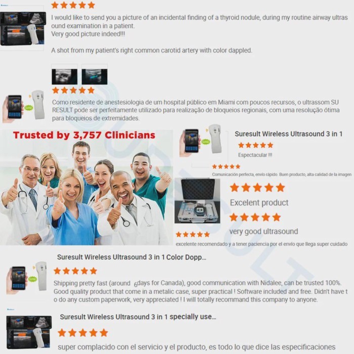 ExcellentModel C5PL 192 Element 3 In 1 Double Head Wireless Mini Wifi Medical Wireless Ultrasound P