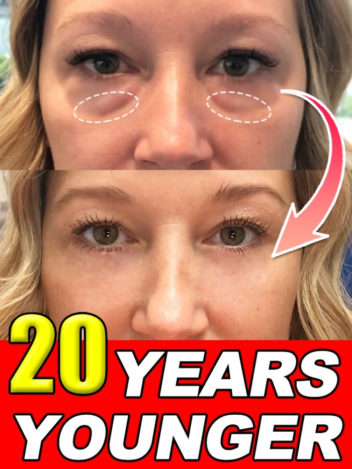 Instant Eye Bag Remover Gel-Cream Erase Bags Under Eyes | Dark Circle Corrector | 7 Days Visible