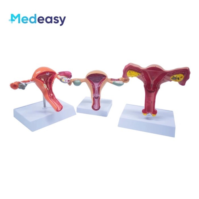Female Uterus and Ovary Anatomical Model Vagina Model Plastic Uterus Model Normal/Diseased Uterus M