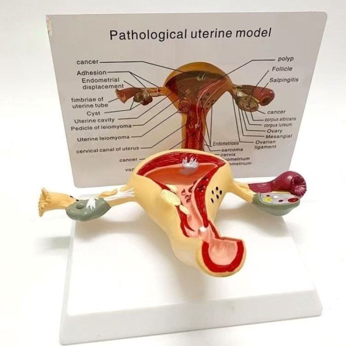 Anatomical Cross Section Bilateral Ovarian Uterus Model pathological Uterus Ovary Model 1:1Female R