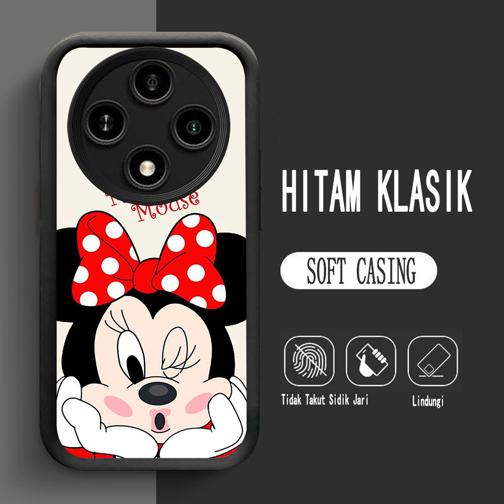 เคสสําหรับ Xiaomi POCO X3 A3X Redmi 14C X7 C61 A3 C75 Pro 5G Soft L-9 Minnie