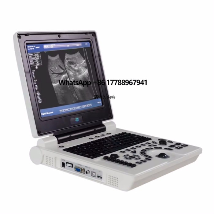SRB-06 Hot Selling Veterinarian Portable Black and White Ecological Scanner Ultrasound Scanner
