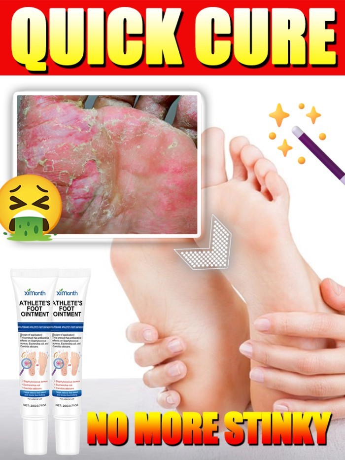 Kill foot fungus, solve foot odor, athlete's foot, itching between toenails, peeling, redness and s