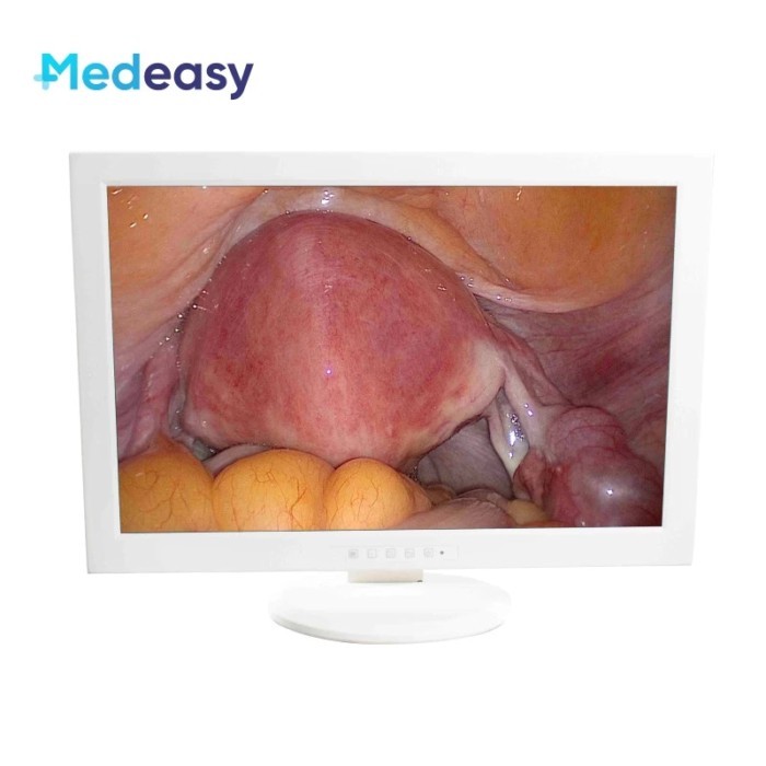 ,15/21/24/27 Inch Endoscopic Medical Grade LCD Monitor, Endoscopy Medical Monitor
