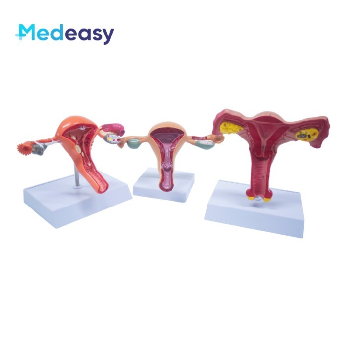 Female Uterus and Ovary Anatomical Model Vagina Model Plastic Uterus Model Normal/Diseased Uterus M