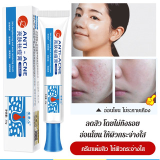 【2 ชิ้น】ครีมแต้มสิว ฟื้นฟูใบหน้า วันครีมกำจัดสิว ครีมแต้มสิว