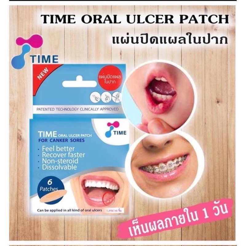 Time Oral Ulcer Patch / Mouth Ulcers (กล่อง 6 ชิ้น) /PAINFUL ULCER RELIEF
