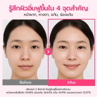 [Numbuzin Official] เซรั่ม PDRN หน้าอิ่มเด้ง No.2 Rose PDRN Collagen Plumping Serum 30ml