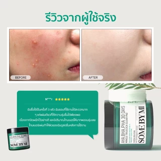 SOME BY MI AHA.BHA.PHA 30 Days Miracle Truecica Clear Pad [70ea,125ml], ช่วยผลัดเซลล์ผิวที่เสื่อมสภาพอย่างอ่อนโยน, ควบคุมความมันส่วนเกินเพื่อผิวสมดุล
