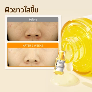 SOME BY MI Yuja Niacin Anti-Blemish Serum [50ml], ปรับสีผิว, ลดรอยสิว, ผิวกระจ่างใส