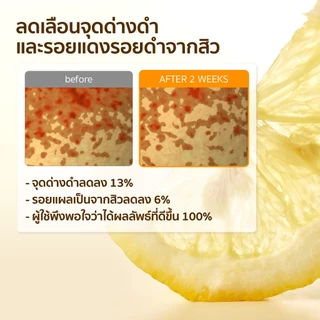 SOME BY MI Yuja Niacin Anti-Blemish Serum [50ml], ปรับสีผิว, ลดรอยสิว, ผิวกระจ่างใส